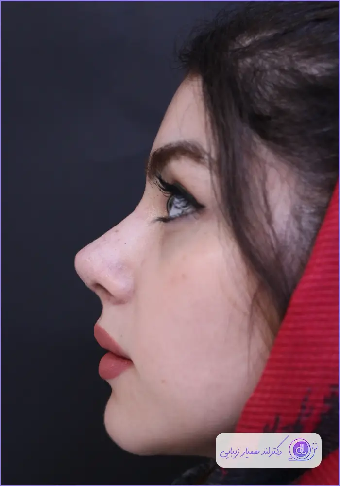 بهترین جراح انحراف بینی در تهران | معرفی ۵ پزشک متخصص سپتوپلاستی بهترین جراح انحراف بینی در تهران | معرفی ۵ پزشک متخصص سپتوپلاستی