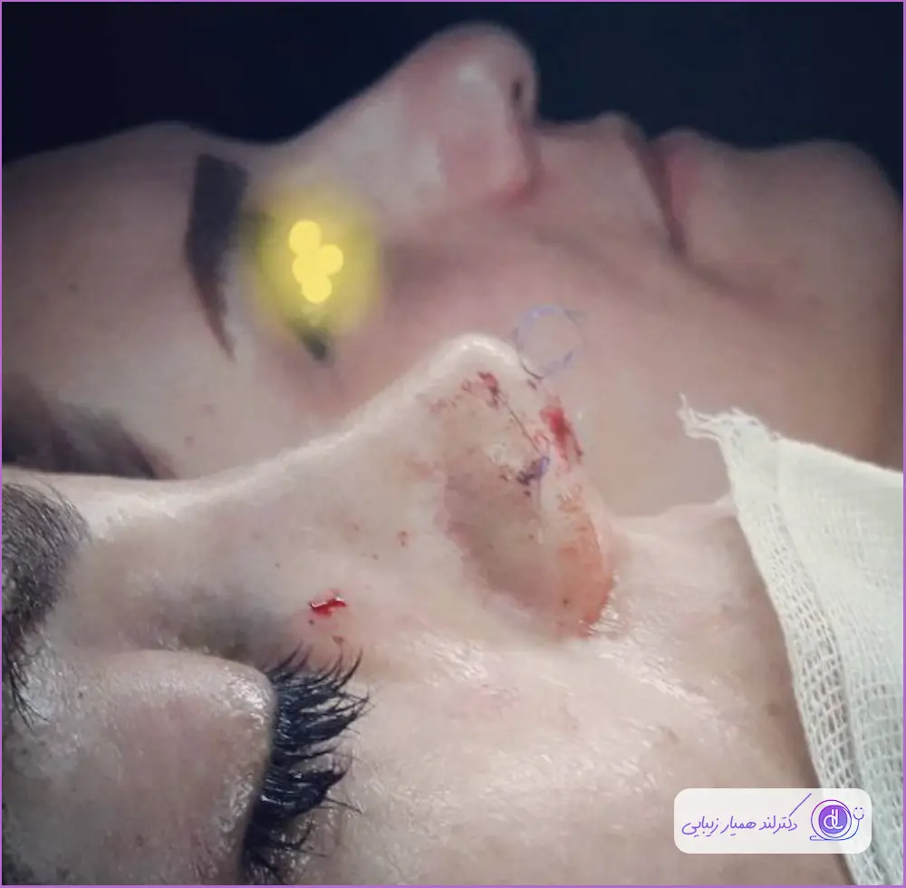 بهترین جراح بینی در اصفهان ۱۴۰۴ + لیست ۱۰ پزشک برتر بهترین جراح بینی در اصفهان-دکتر ایمان محمدی-2