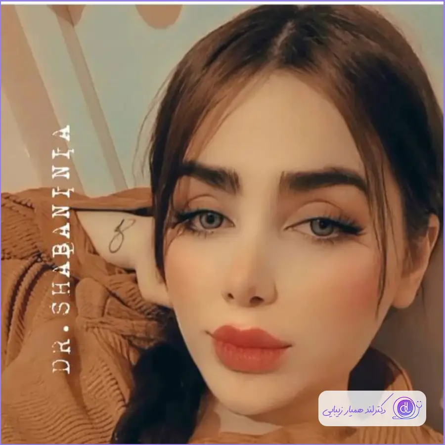 بهترین جراح بینی طبیعی در تهران | معرفی 5 پزشک برتر + هزینه و نمونهکار نمونه کارهای دکتر شهریار شعبانی نیا-1