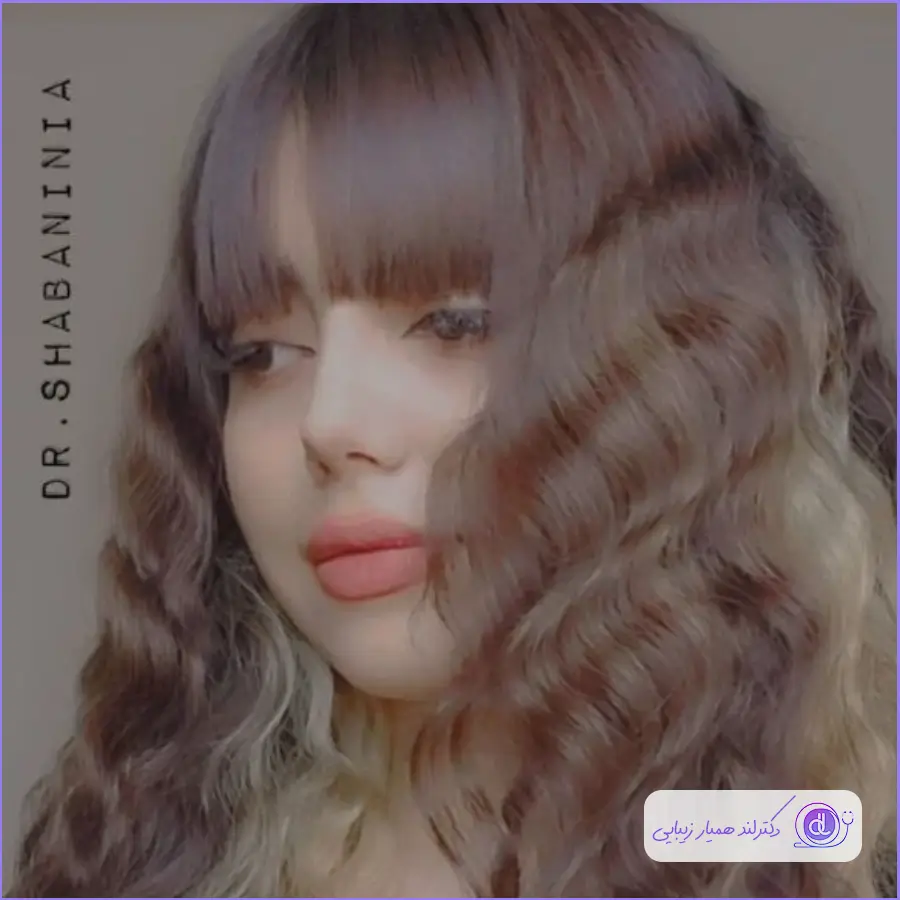 بهترین جراح انحراف بینی در تهران | معرفی ۵ پزشک متخصص سپتوپلاستی بهترین جراح انحراف بینی در تهران | معرفی ۵ پزشک متخصص سپتوپلاستی