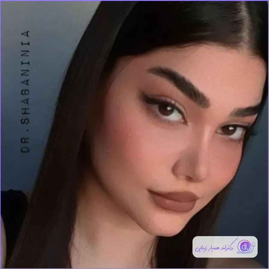 بهترین جراح بینی طبیعی در تهران | معرفی 5 پزشک برتر + هزینه و نمونهکار نمونه کارهای دکتر شهریار شعبانی نیا-4