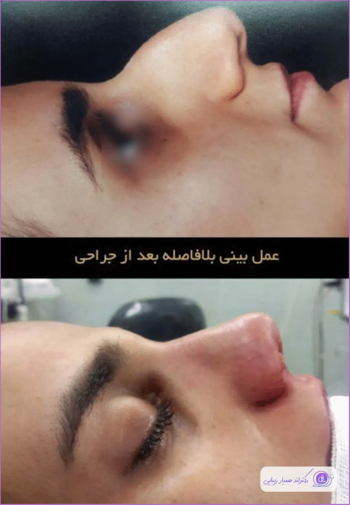 بهترین جراح بینی استخوانی در اصفهان-دکتر فهیمه بیاتی