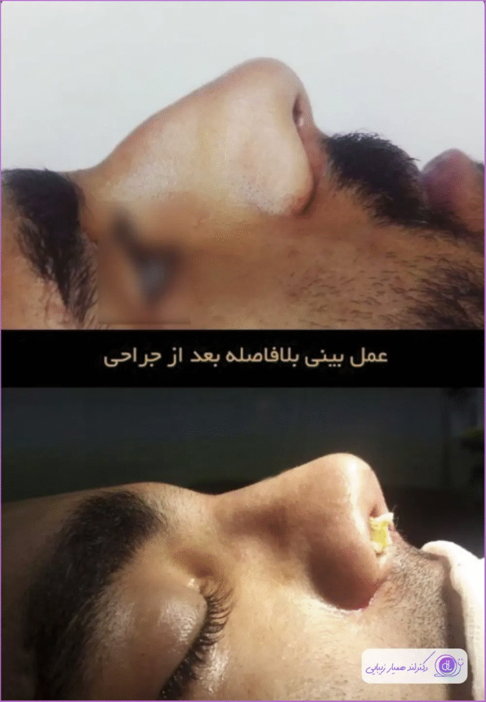 بهترین جراح بینی استخوانی در اصفهان-دکتر فهیمه بیاتی-1