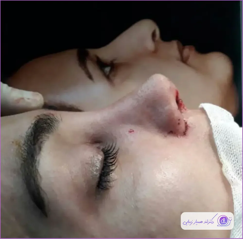 بهترین جراح بینی گوشتی در اصفهان ۱۴۰۴ | معرفی متخصصان برتر و هزینه عمل بهترین جراح بینی گوشتی در اصفهان-دکتر ایمان محمدی-3