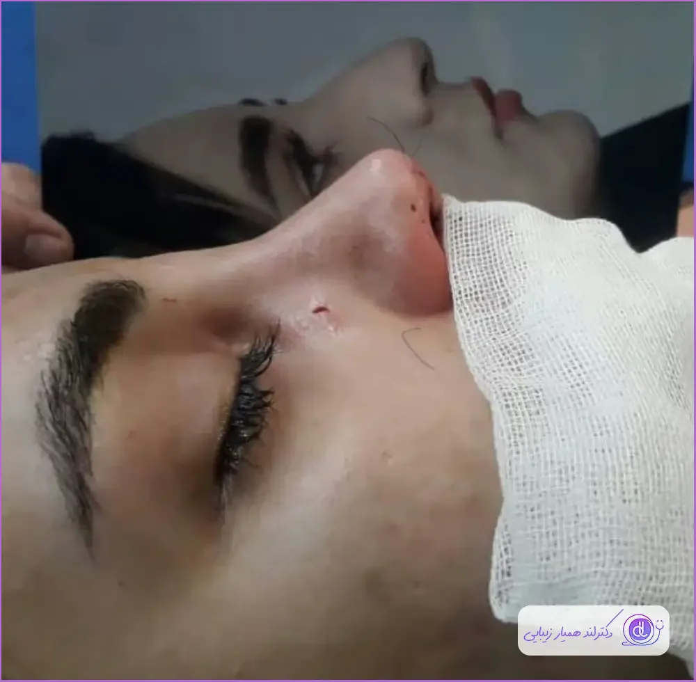 بهترین جراح بینی در اصفهان ۱۴۰۴ + لیست ۱۰ پزشک برتر بهترین جراح بینی در اصفهان-دکتر ایمان محمدی