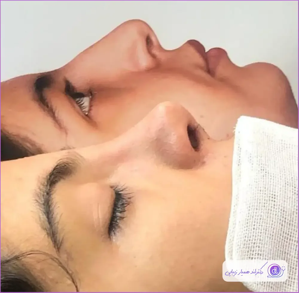 بهترین جراح بینی در اصفهان ۱۴۰۴ + لیست ۱۰ پزشک برتر بهترین جراح بینی در اصفهان-دکتر ایمان محمدی-1