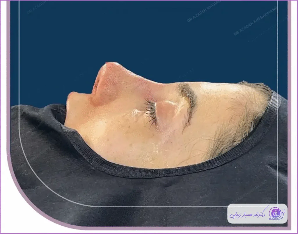 بهترین جراح بینی گوشتی در اصفهان ۱۴۰۴ | معرفی متخصصان برتر و هزینه عمل بهترین جراح بینی گوشتی در اصفهان-دکتر آزاده خردمند-8