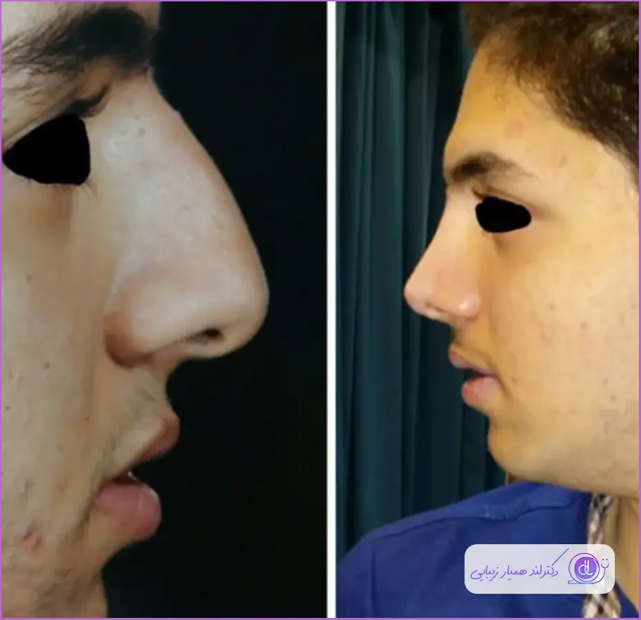 بهترین جراح بینی گوشتی در اصفهان ۱۴۰۴ | معرفی متخصصان برتر و هزینه عمل بهترین جراح بینی گوشتی در اصفهان-دکتر حنیف اخوت-1