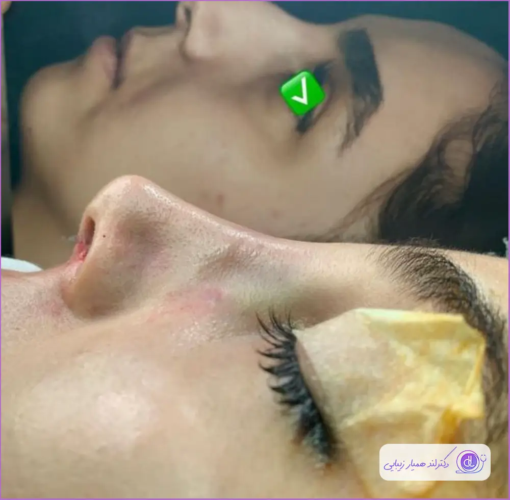 بهترین جراح بینی استخوانی در اصفهان-دکتر ایمان محمدی-2