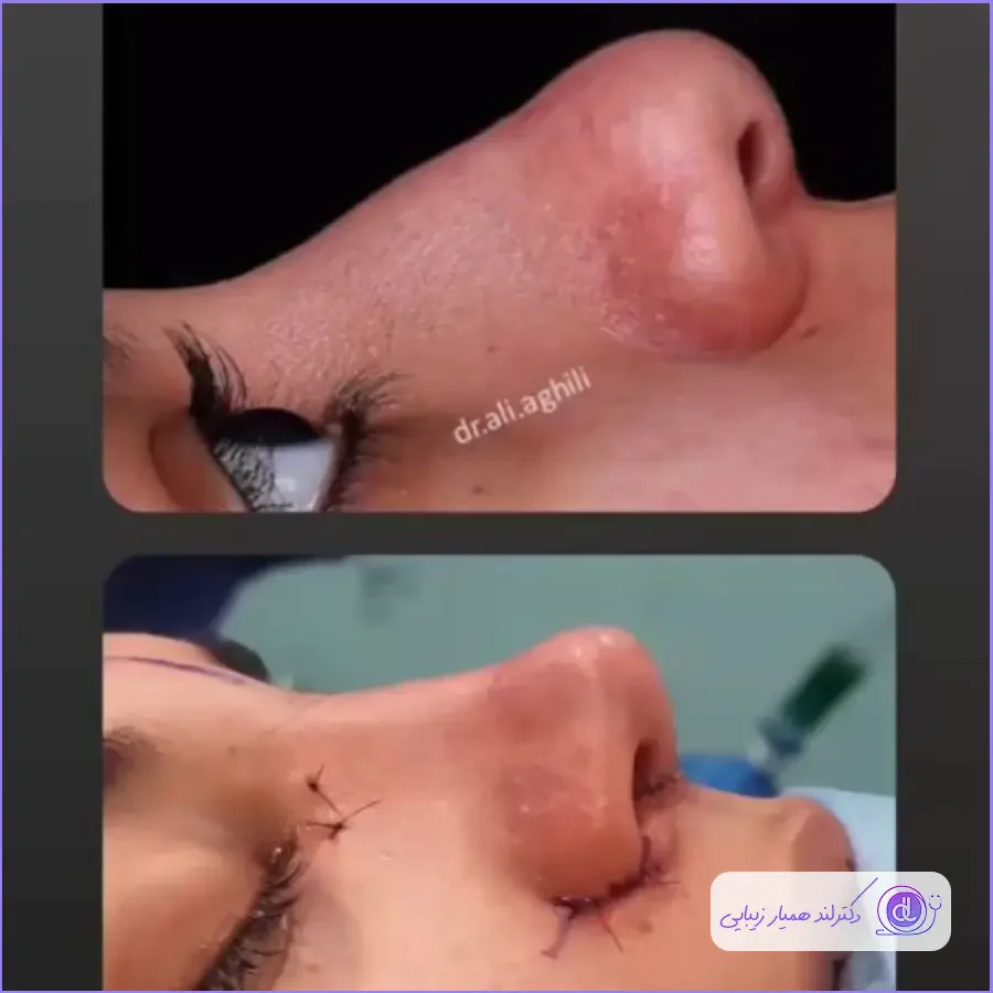 بهترین جراح بینی استخوانی در تهران | معرفی ۳۰ پزشک برتر + هزینه و نمونهکار بهترین جراح بینی استخوانی در تهران-1