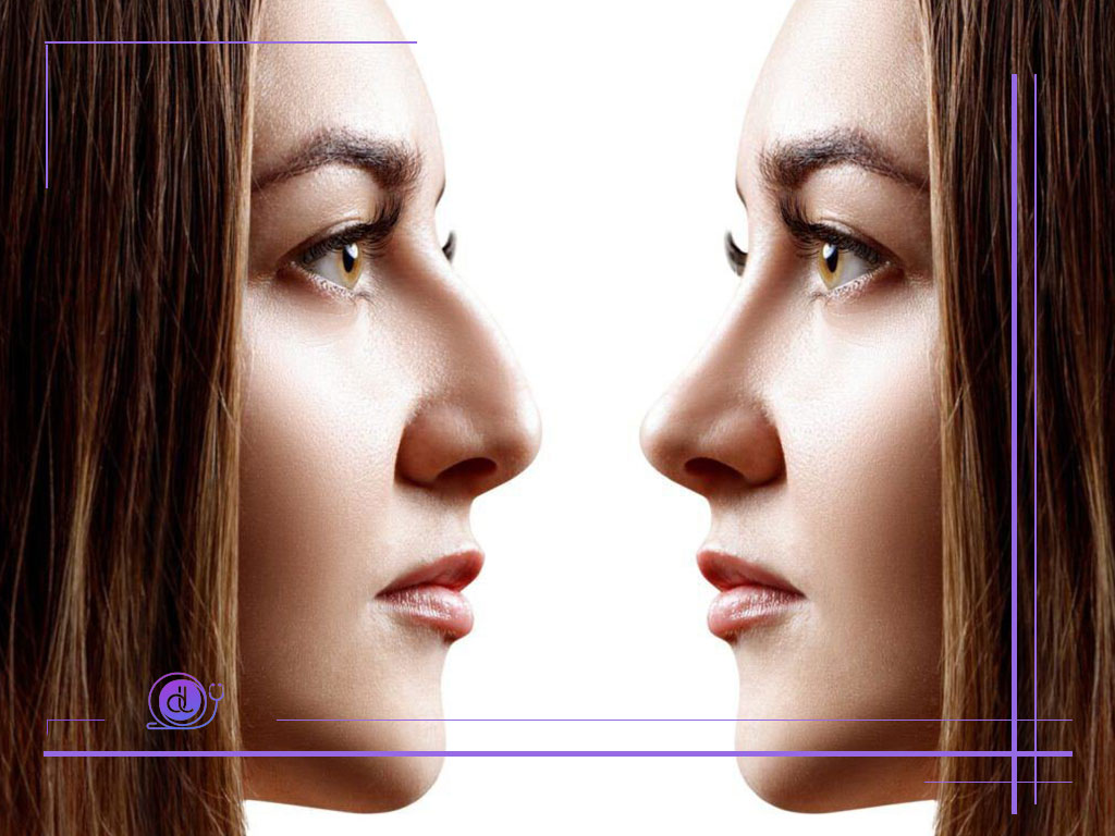 هزینه عمل بینی در اصفهان