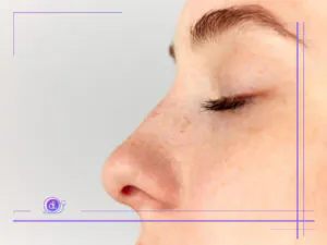 بهترین جراح بینی طبیعی در تهران