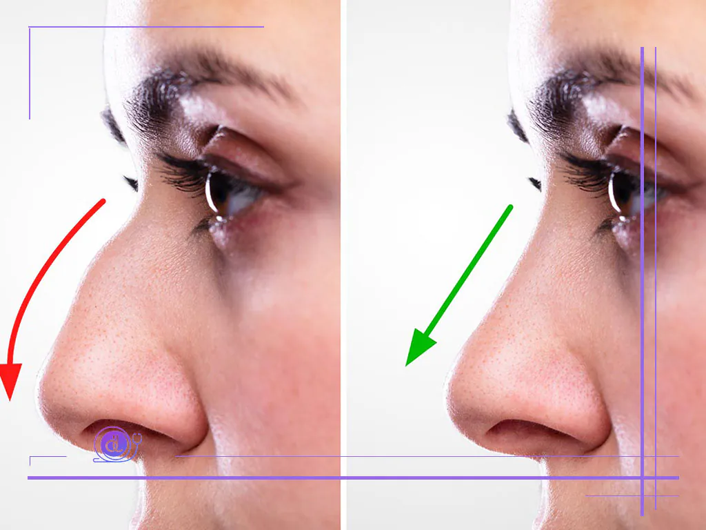 بهترین جراح بینی طبیعی در تهران | معرفی 5 پزشک برتر + هزینه و نمونهکار بهترین جراح بینی طبیعی در تهران-21