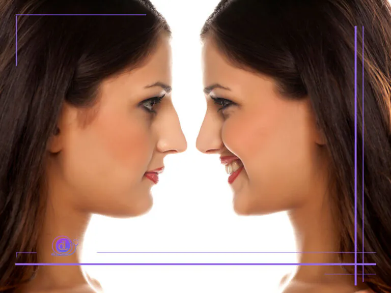 هزینه عمل بینی استخوانی در تهران