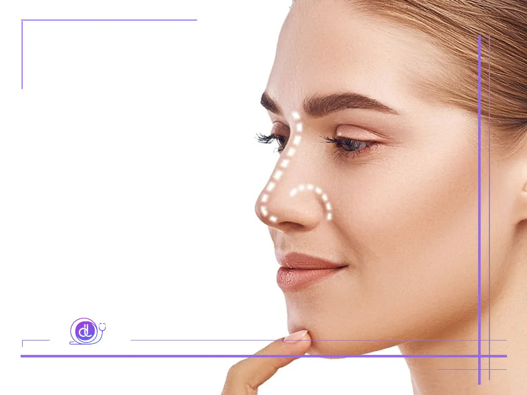 هزینه عمل بینی گوشتی در تهران (۱۴۰۴) هزینه عمل بینی گوشتی در تهران-1