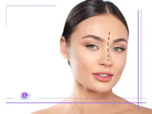 هزینه عمل بینی گوشتی در تهران