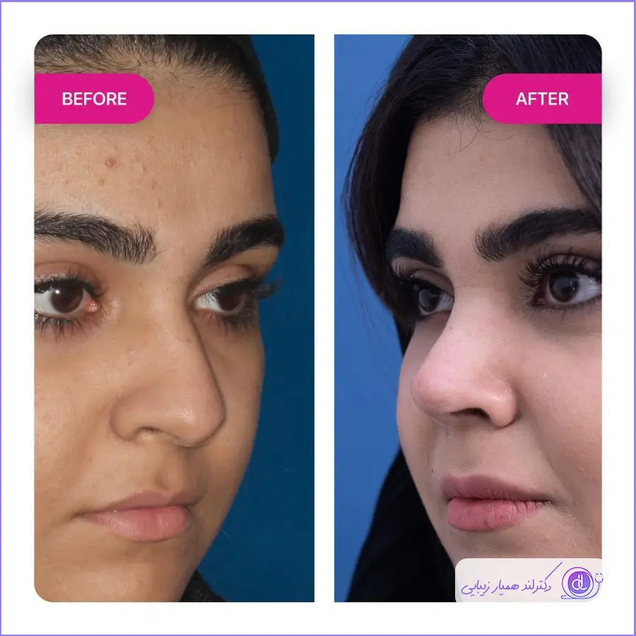 بهترین جراح بینی در کرج | معرفی پزشکان برتر + هزینه عمل بینی بهترین جراح بینی در کرج-4