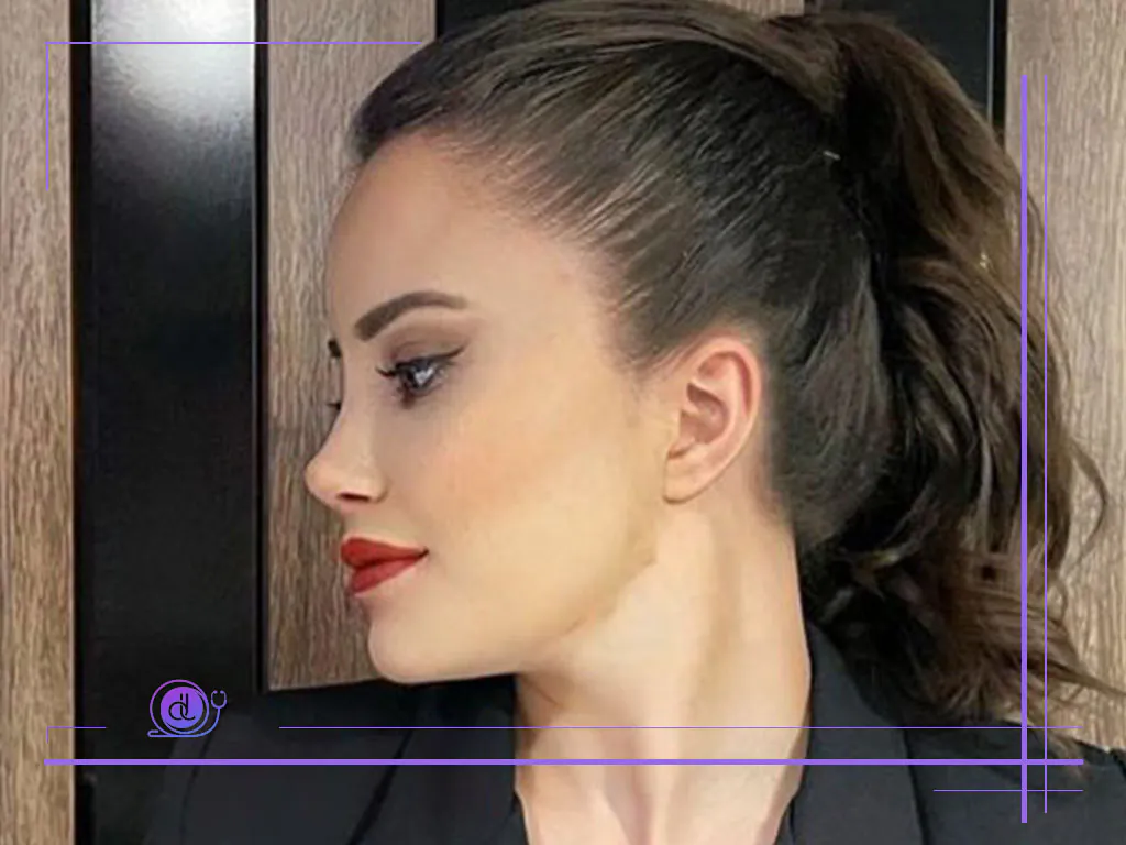 بهترین جراح بینی فانتزی در تهران بهترین جراح بینی فانتزی در تهران-1