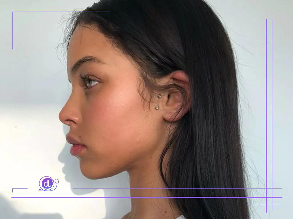 بهترین جراح بینی فانتزی در تهران بهترین جراح بینی فانتزی در تهران-3