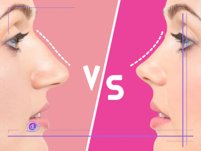 بهترین جراح بینی فانتزی در تهران