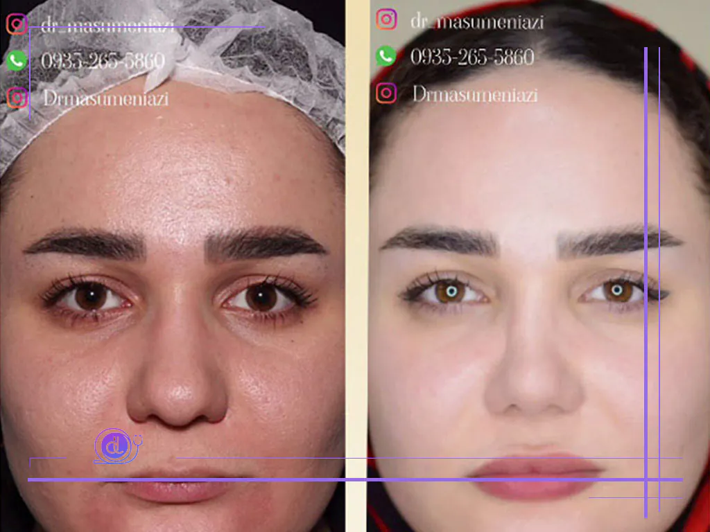 بهترین جراح بینی در کرج | معرفی پزشکان برتر + هزینه عمل بینی بهترین جراح بینی در کرج-5