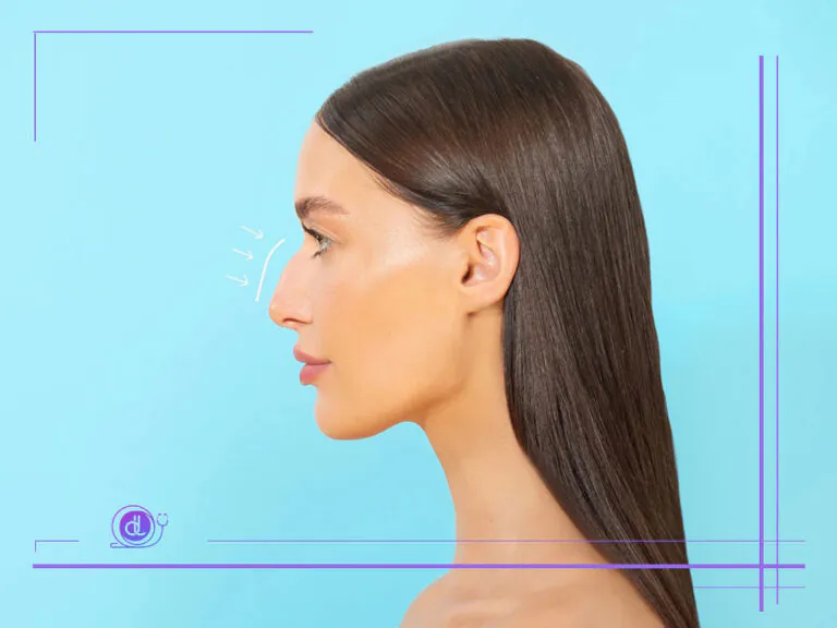 هزینه عمل بینی استخوانی در شیراز-عکس شاخص