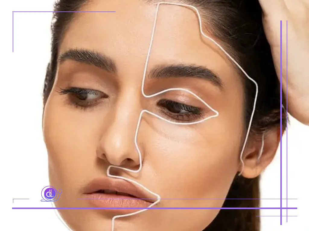 هزینه عمل بینی گوشتی در شیراز-2