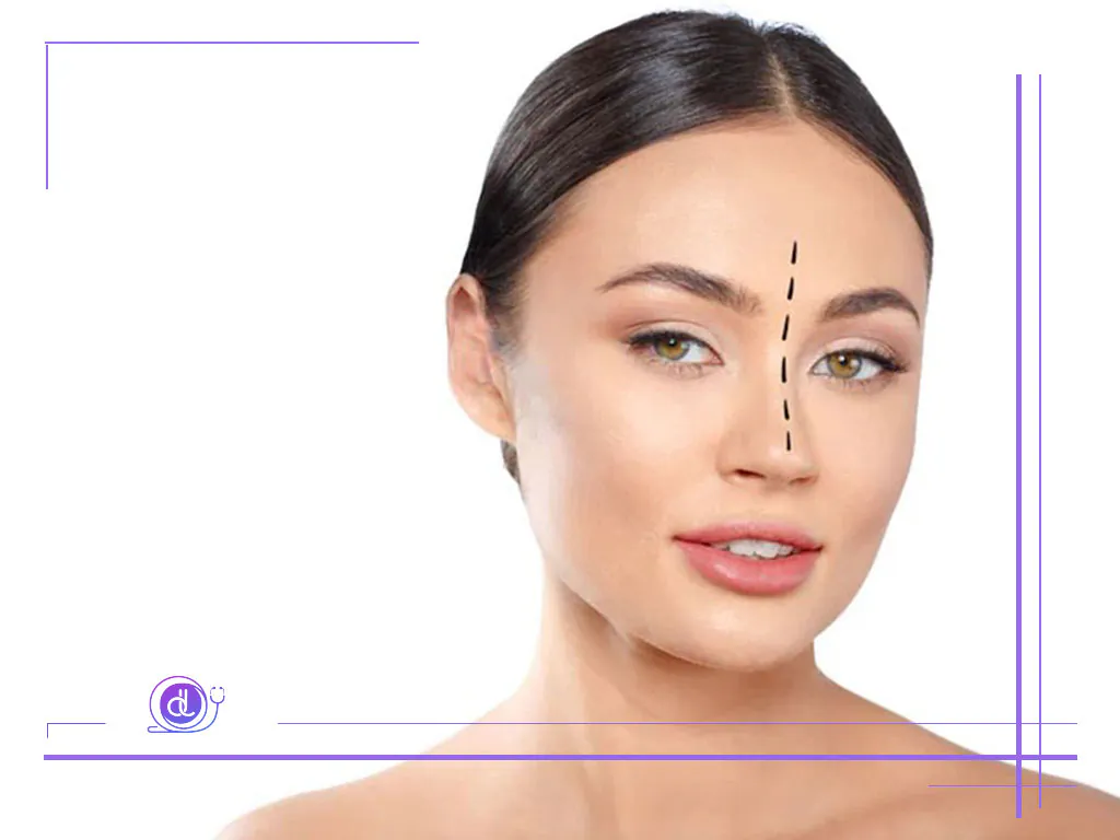 هزینه عمل بینی گوشتی در شیراز-1